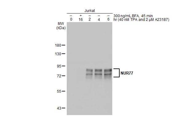 Untreated and treated Jurkat whole cell extracts (30 ug) were separated by 7.5% SDS-PAGE, and the membrane was blotted with NUR77 antibody (NBP2-19613) diluted at 1:500. The HRP-conjugated anti-rabbit IgG antibody  was used to detect the primary antibody. 