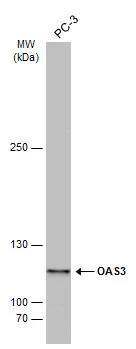 Whole cell extract (30 ug) was separated by 5% SDS-PAGE, and the membrane was blotted with OAS3 antibody (NBP2-19617) diluted at 1:3000. The HRP-conjugated anti-rabbit IgG antibody  was used to detect the primary antibody. 