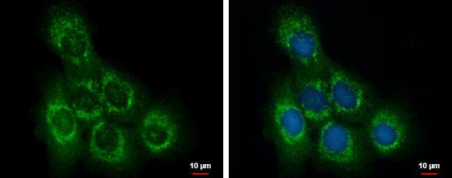 OCRL antibody detects OCRL protein at cytoplasm by immunofluorescent analysis.Sample: A431 cells were fixed in ice-cold MeOH for 5 min.Green: OCRL protein stained by OCRL antibody (NBP2-19621) diluted at 1:500.Blue: Hoechst 33342 staining. 