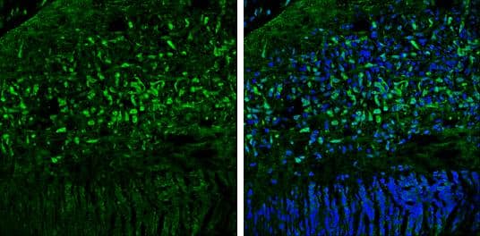 OGFOD1 antibody [N1N3] detects OGFOD1 protein expression by immunohistochemical analysis.Sample: Frozen sectioned E13.5 Rat brain. Green: OGFOD1 protein stained by OGFOD1 antibody [N1N3] (NBP2-19624) diluted at 1:250.Blue: Fluoroshield with DAPI . 