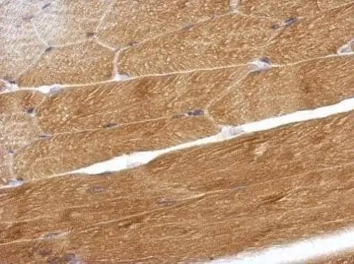Immunohistochemical analysis of paraffin-embedded mouse muscle, using OMD(NBP2-19626) antibody at 1:500 dilution. br>Antigen Retrieval: Trilogy(TM) (EDTA based, pH 8.0) buffer, 15min 
