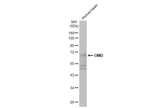 Human heart (30 ug) was separated by 10% SDS-PAGE, and the membrane was blotted with OMD antibody (NBP2-19626) diluted at 1:500. The HRP-conjugated anti-rabbit IgG antibody  was used to detect the primary antibody, and the signal was developed with Trident ECL plus-Enhanced. 