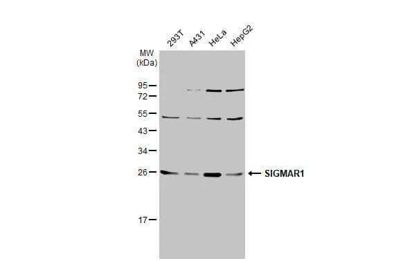 Various whole cell extracts (30 ug) were separated by 12% SDS-PAGE, and the membrane was blotted with SIGMAR1 antibody [N1C3] (NBP2-19628) diluted at 1:1000. The HRP-conjugated anti-rabbit IgG antibody  was used to detect the primary antibody. 