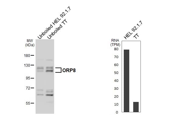 Unboiled various whole cell extracts (30 ug) were separated by 7.5% SDS-PAGE, and the membrane was blotted with ORP8 antibody (NBP2-19634) diluted at 1:1000. The HRP-conjugated anti-rabbit IgG antibody  was used to detect the primary antibody. Corresponding RNA expression data for the same cell lines are based on Human Protein Atlas program. 