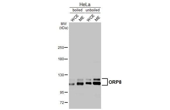 Boiled and unboiled HeLa whole cell and membrane extracts (30 ug) were separated by 5% SDS-PAGE, and the membrane was blotted with ORP8 antibody (NBP2-19634) diluted at 1:1000. The HRP-conjugated anti-rabbit IgG antibody  was used to detect the primary antibody. (WCE: whole cell extract; ME: membrane extract) 