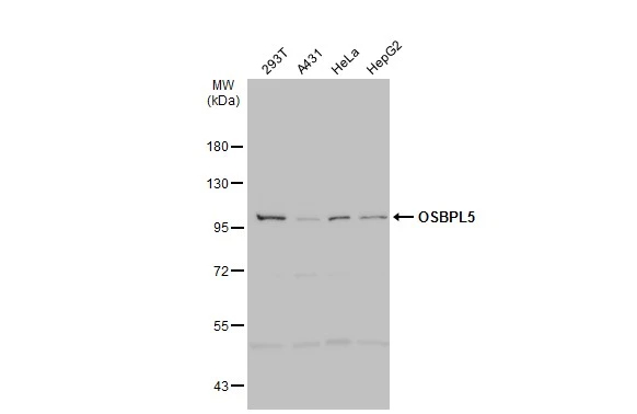 Western Blot: OSBPL5 Antibody [NBP2-19638] - Various whole cell extracts (30 ug) were separated by 7.5% SDS-PAGE, and the membrane was blotted with OSBPL5 antibody [N3C1], Internal (NBP2-19638) diluted at 1:500. The HRP-conjugated anti-rabbit IgG antibody  was used to detect the primary antibody.
