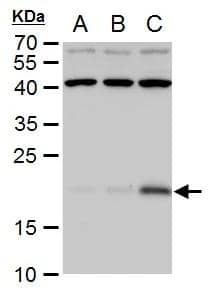 p21 antibody detects p21 protein by Western blot analysis.A. 30 ug HCT116 whole cell extract (untreated)B. 30 ug HCT116 whole cell extract (30 uM Cisplatin treatment for 24 h)C. 30 ug HCT116 whole cell extract (30 uM Cisplatin treatment for 48 h) 12 % SDS-PAGEp21 antibody (NBP2-19652) dilution: 1:1000 
