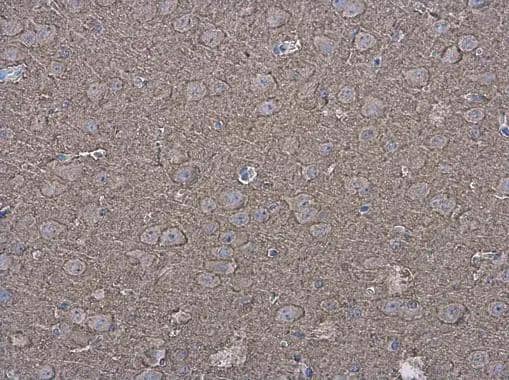 P2X7 antibody detects P2X7 protein at cell membrane and cytoplasm in mouse brain by immunohistochemical analysis. Sample: Paraffin-embedded mouse brain. P2X7 antibody (NBP2-19654) diluted at 1:500. br>Antigen Retrieval: Citrate buffer, pH 6.0, 15 min 
