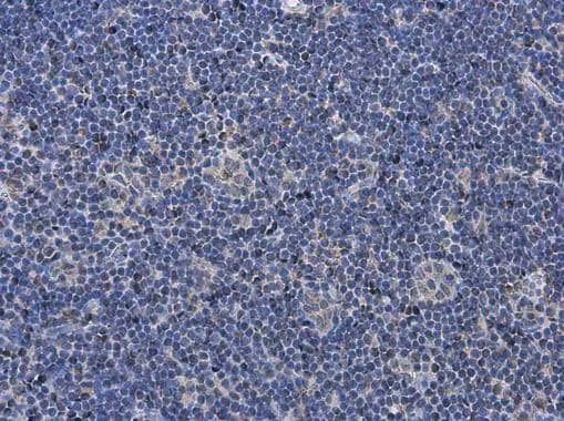 P2X7 antibody detects P2X7 protein at cell membrane and cytoplasm in rat lymph node by immunohistochemical analysis. Sample: Paraffin-embedded rat lymph node. P2X7 antibody (NBP2-19654) diluted at 1:500. br>Antigen Retrieval: Citrate buffer, pH 6.0, 15 min 
