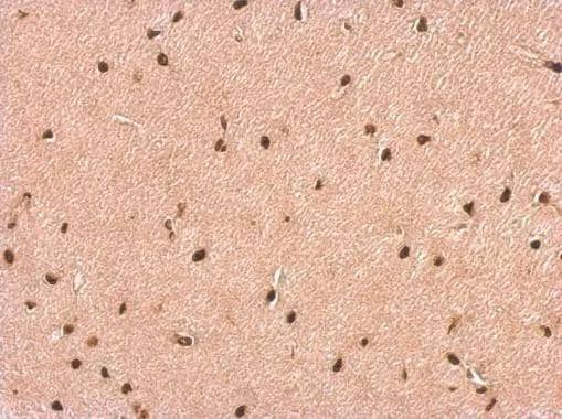 Immunohistochemistry P2X2/P2RX2 Antibody - BSA Free