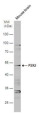 Western Blot P2X2/P2RX2 Antibody
