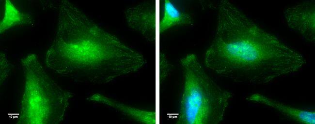 p38 MAPK antibody [N1C3-2] detects p38 MAPK protein at cytoplasm and nucleus by immunofluorescent analysis.Sample: HeLa cells were fixed in 4% paraformaldehyde for 10 min.Green: p38 MAPK protein stained by p38 MAPK antibody [N1C3-2] (NBP2-19662) diluted at 1:100.Blue: Hoechst 33342 staining.Scale bar = 10 um. 