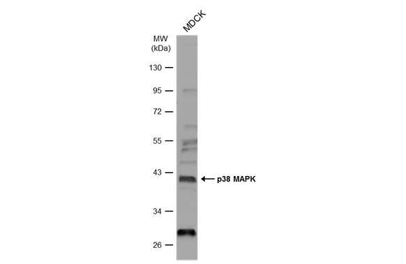 Whole cell extract (30 ug) was separated by 10% SDS-PAGE, and the membrane was blotted with p38 MAPK antibody (NBP2-19662) diluted at 1:500. The HRP-conjugated anti-rabbit IgG antibody  was used to detect the primary antibody. 