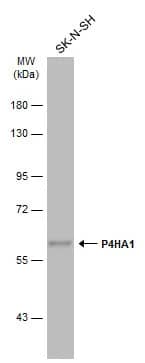 Western Blot: P4HA1 Antibody [NBP2-19664] - Whole cell extract (30 ug) was separated by 7.5% SDS-PAGE, and the membrane was blotted with P4HA1 antibody [C1C3] (NBP2-19664) diluted at 1:1000. The HRP-conjugated anti-rabbit IgG antibody  was used to detect the primary antibody.