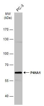 Western Blot: P4HA1 Antibody [NBP2-19664] - Whole cell extract (30 ug) was separated by 7.5% SDS-PAGE, and the membrane was blotted with P4HA1 antibody [C1C3] (NBP2-19664) diluted at 1:1000. The HRP-conjugated anti-rabbit IgG antibody  was used to detect the primary antibody.