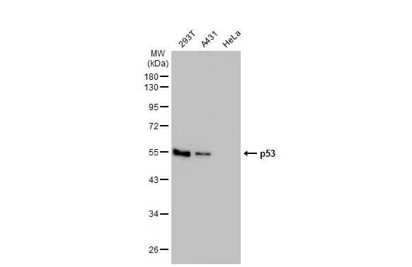 Whole cell extract (30 ug) were separated by 10% SDS-PAGE, and the membrane was blotted with p53 antibody [N1], N-term (NBP2-19667) diluted at 1:1000. The HRP-conjugated anti-rabbit IgG antibody  was used to detect the primary antibody. 