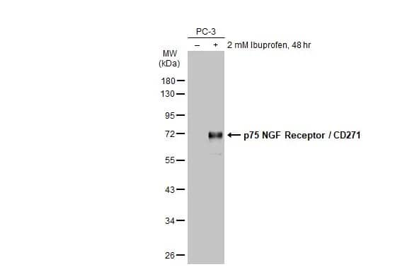 Western Blot: NGFR/TNFRSF16/p75NTR Antibody [NBP2-19669] - Untreated (-) and treated (+) PC-3 whole cell extracts (30 ug) were separated by 10% SDS-PAGE, and the membrane was blotted with NGFR/TNFRSF16/p75NTR antibody (NBP2-19669) diluted at 1:1000. The HRP-conjugated anti-rabbit IgG antibody  was used to detect the primary antibody.