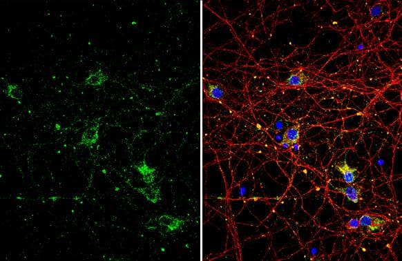 p75 NGF Receptor / CD271 antibody detects p75 NGF Receptor / CD271 protein by immunofluorescent analysis.Sample: DIV10 rat E18 primary cortical neuron cells were fixed in 4% paraformaldehyde at RT for 15 min.Green: p75 NGF Receptor / CD271 stained by p75 NGF Receptor / CD271 antibody (NBP2-19669) diluted at 1:500.Red: Tau, stained by Tau antibody [GT287]  diluted at 1:500.Blue: Fluoroshield with DAPI . 