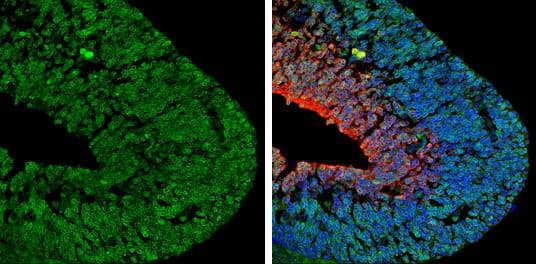 p75 NGF Receptor antibody detects p75 NGF Receptor protein expression by immunohistochemical analysis.Sample: Frozen sectioned E13.5 Rat brain. Green: p75 NGF Receptor protein stained by p75 NGF Receptor antibody (NBP2-19669) diluted at 1:250.Red: beta Tubulin 3/ TUJ1, a mature neuron marker, stained by beta Tubulin 3/ TUJ1 antibody [GT11710]  diluted at 1:500.Blue: Fluoroshield with DAPI . 