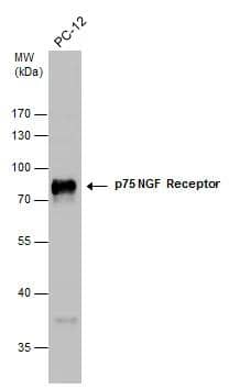 p75 NGF Receptor antibody detects p75 NGF Receptor protein by western blot analysis. Whole cell extracts (30 ug) was separated by 10% SDS-PAGE, and the membrane was blotted with p75 NGF Receptor antibody (NBP2-19669) at a dilution of 1:2000. 