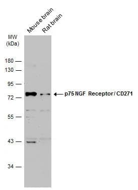Various tissue extracts (50 ug) were separated by 10% SDS-PAGE, and the membrane was blotted with p75 NGF Receptor / CD271 antibody (NBP2-19669) diluted at 1:2000. The HRP-conjugated anti-rabbit IgG antibody  was used to detect the primary antibody. 