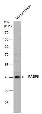 PABP5 antibody detects PABP5 protein by western blot analysis. Mouse tissue extracts (50 ug) was separated by 10 % SDS-PAGE, and the membrane was blotted with PABP5 antibody (NBP2-19672) diluted by 1:1000. 