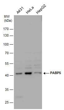 PABP5 antibody detects PABP5 protein by western blot analysis. Various whole cell extracts (30 ug) were separated by 10% SDS-PAGE, and the membrane was blotted with PABP5 antibody (NBP2-19672) diluted by 1:1000. 