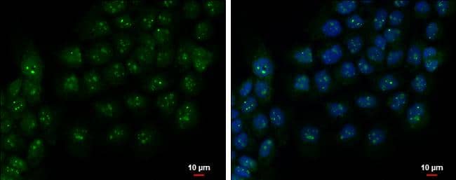 Immunocytochemistry/ Immunofluorescence PAF49 Antibody - BSA Free