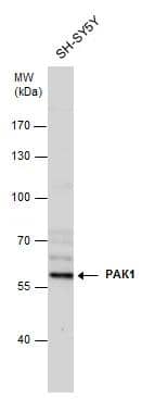 PAK1 antibody detects PAK1 protein by western blot analysis. Whole cell extracts (30 ug) was separated by 7.5% SDS-PAGE, and the membrane was blotted with PAK1 antibody (NBP2-19680) diluted at 1:1000. The HRP-conjugated anti-rabbit IgG antibody  was used to detect the primary antibody. 