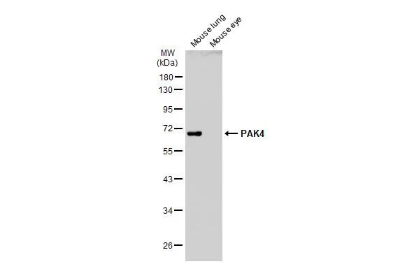 Western Blot: PAK4 Antibody [NBP2-19683] - Various tissue extracts (50 ug) were separated by 10% SDS-PAGE, and the membrane was blotted with PAK4 antibody [C1C3] (NBP2-19683) diluted at 1:500. The HRP-conjugated anti-rabbit IgG antibody  was used to detect the primary antibody.