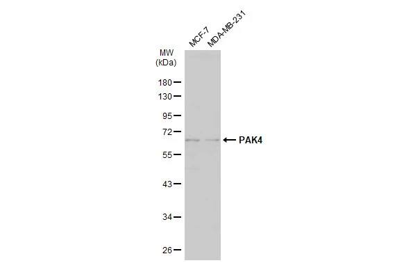 Western Blot: PAK4 Antibody [NBP2-19683] - Various whole cell extracts (30 ug) were separated by 10% SDS-PAGE, and the membrane was blotted with PAK4 antibody [C1C3] (NBP2-19683) diluted at 1:500. The HRP-conjugated anti-rabbit IgG antibody  was used to detect the primary antibody.