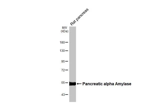 Rat tissue extract (50 ug) was separated by 7.5% SDS-PAGE, and the membrane was blotted with Pancreatic alpha Amylase antibody [N2C2] (NBP2-19687) diluted at 1:1000. The HRP-conjugated anti-rabbit IgG antibody  was used to detect the primary antibody. 