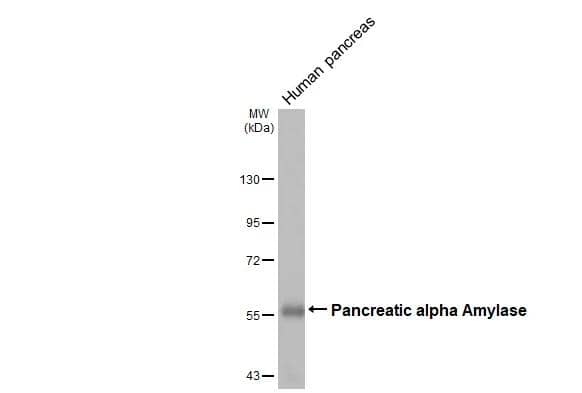 Human pancreas (30 ug) was separated by 7.5% SDS-PAGE, and the membrane was blotted with Pancreatic alpha Amylase antibody [N2C2], Internal (NBP2-19687) diluted at 1:1000. The HRP-conjugated anti-rabbit IgG antibody  was used to detect the primary antibody. 