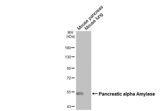 Various tissue extracts (50 ug) were separated by 7.5% SDS-PAGE, and the membrane was blotted with Pancreatic alpha Amylase antibody [N2C2] (NBP2-19687) diluted at 1:1000. The HRP-conjugated anti-rabbit IgG antibody  was used to detect the primary antibody. 