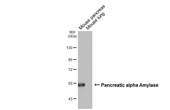Various tissue extracts (50 ug) were separated by 7.5% SDS-PAGE, and the membrane was blotted with Pancreatic alpha Amylase antibody [N3C3] (NBP2-19688) diluted at 1:3000. The HRP-conjugated anti-rabbit IgG antibody  was used to detect the primary antibody. 