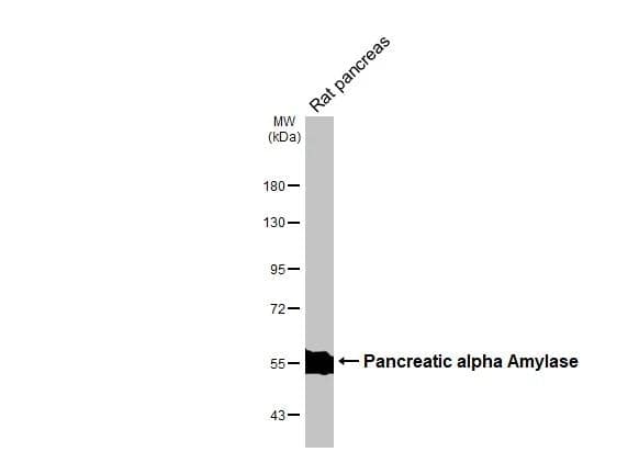 Rat tissue extract (50 ug) was separated by 7.5% SDS-PAGE, and the membrane was blotted with Pancreatic alpha Amylase antibody [N3C3] (NBP2-19688) diluted at 1:1000. The HRP-conjugated anti-rabbit IgG antibody  was used to detect the primary antibody. 