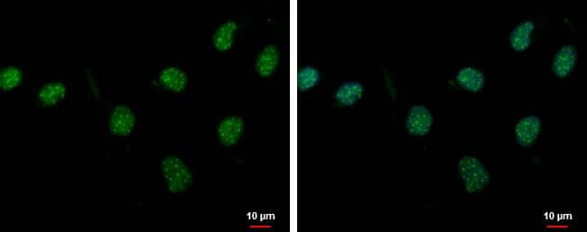 PASD1 antibody detects PASD1 protein at nucleus by immunofluorescent analysis.Sample: NT2D1 cells were fixed in 4% paraformaldehyde at RT for 15 min.Green: PASD1 protein stained by PASD1 antibody (NBP2-19703) diluted at 1:500.Blue: Hoechst 33342 staining. 