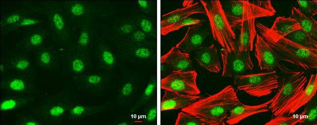 PAX6 antibody detects PAX6 protein at nucleus by immunofluorescent analysis.Sample: SK-N-SH cells were fixed in 4% paraformaldehyde at RT for 15 min.Green: PAX6 protein stained by PAX6 antibody (NBP2-19711) diluted at 1:500.Red: Phalloidin, a cytoskeleton marker, diluted at 1:50.Scale bar = 10 um. 