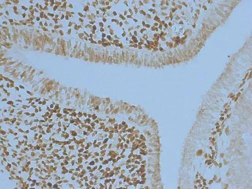 PAX6 antibody detects PAX6 protein at nucleus in embryonic mouse brain by immunohistochemical analysis. Sample: Frozen section of embryonic mouse brain (mE12.5). PAX6 antibody (NBP2-19711) diluted at 1:250. 