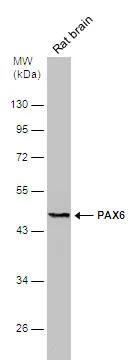 Rat tissue extract (50 ug) was separated by 10% SDS-PAGE, and the membrane was blotted with PAX6 antibody (NBP2-19711) diluted at 1:500. The HRP-conjugated anti-rabbit IgG antibody  was used to detect the primary antibody. 