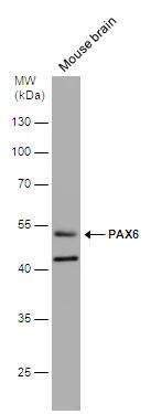 Mouse tissue extract (50 ug) was separated by 10% SDS-PAGE, and the membrane was blotted with PAX6 antibody (NBP2-19711) diluted at 1:1000. The HRP-conjugated anti-rabbit IgG antibody  was used to detect the primary antibody. 