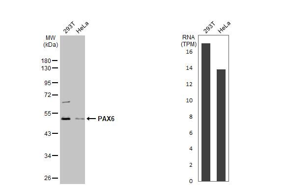 Various whole cell extracts (30 ug) were separated by 10% SDS-PAGE, and the membrane was blotted with PAX6 antibody (NBP2-19711) diluted at 1:1000. The HRP-conjugated anti-rabbit IgG antibody  was used to detect the primary antibody. Corresponding RNA expression data for the same cell lines are based on Human Protein Atlas program. 