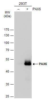 Non-transfected (-) and transfected (+) 293T whole cell extracts (30 ug) were separated by 10% SDS-PAGE, and the membrane was blotted with PAX6 antibody (NBP2-19711) diluted at 1:1000. The HRP-conjugated anti-rabbit IgG antibody  was used to detect the primary antibody. 