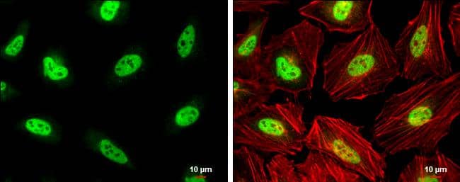 PCBP2 antibody detects PCBP2 protein at nucleus by immunofluorescent analysis.Sample: HeLa cells were fixed in 4% paraformaldehyde at RT for 15 min.Green: PCBP2 protein stained by PCBP2 antibody (NBP2-19715) diluted at 1:750.Red: phalloidin, a cytoskeleton marker, diluted at 1:200.Scale bar = 10 um. 