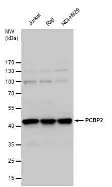 PCBP2 antibody detects PCBP2 protein by western blot analysis. Various whole cell extracts (30 ug) were separated by 12 % SDS-PAGE, and blotted with PCBP2 antibody (NBP2-19715) diluted by 1:1000 