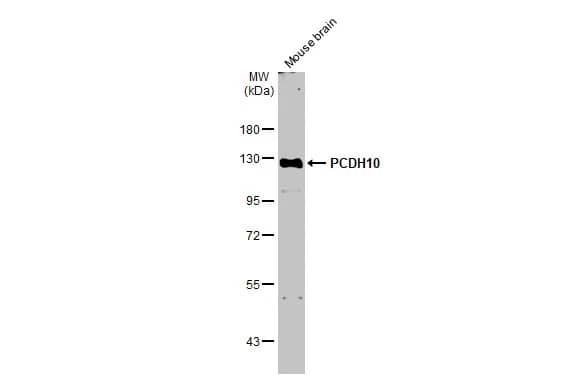 Western Blot: Protocadherin-10 Antibody [NBP2-19720] - Mouse tissue extract (50 ug) was separated by 7.5% SDS-PAGE, and the membrane was blotted with Protocadherin-10 antibody [N1N2], N-term (NBP2-19720) diluted at 1:1000. The HRP-conjugated anti-rabbit IgG antibody  was used to detect the primary antibody.