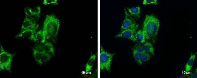 PCK2 antibody detects PCK2 protein at mitochondria by immunofluorescent analysis.Sample: HepG2 cells were fixed in MeOH for 5 min.Green: PCK2 protein stained by PCK2 antibody (NBP2-19729) diluted at 1:500.Blue: Hoechst 33342 staining.Scale bar = 10 um. 