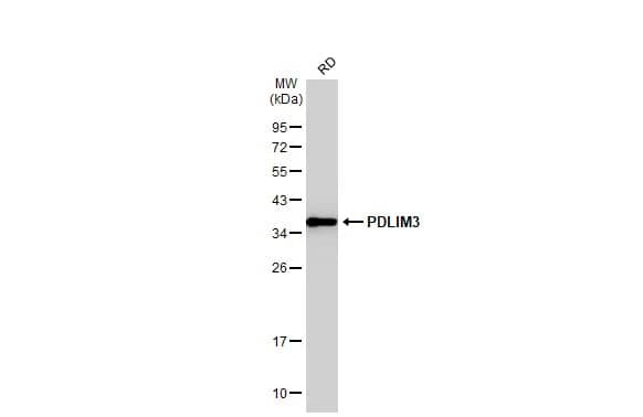 Western Blot: PDLIM3 Antibody [NBP2-19755] - Whole cell extract (30 ug) was separated by 12% SDS-PAGE, and the membrane was blotted with PDLIM3 antibody (NBP2-19755) diluted at 1:10000. The HRP-conjugated anti-rabbit IgG antibody  was used to detect the primary antibody.