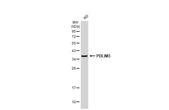 Western Blot: PDLIM3 Antibody [NBP2-19756] - Whole cell extract (30 ug) was separated by 12% SDS-PAGE, and the membrane was blotted with PDLIM3 antibody (NBP2-19756) diluted at 1:1000. The HRP-conjugated anti-rabbit IgG antibody  was used to detect the primary antibody.