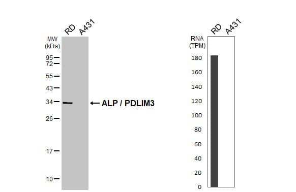 Various whole cell extracts (30 ug) were separated by 12% SDS-PAGE, and the membrane was blotted with ALP / PDLIM3 antibody (NBP2-19756) diluted at 1:500. The HRP-conjugated anti-rabbit IgG antibody  was used to detect the primary antibody. Corresponding RNA expression data for the same cell lines are based on Human Protein Atlas program. 